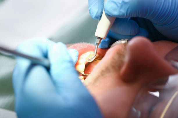 Best Urgent Tooth Repair  in Amity Gardens, PA